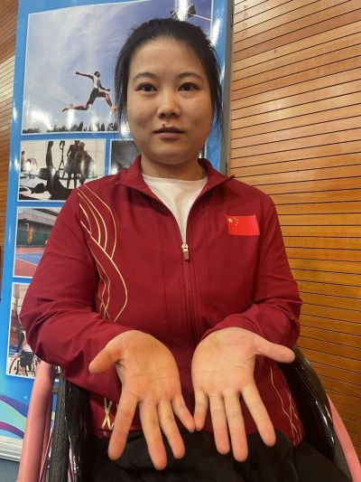 32岁的魏怡布满老茧的双手。.jpg